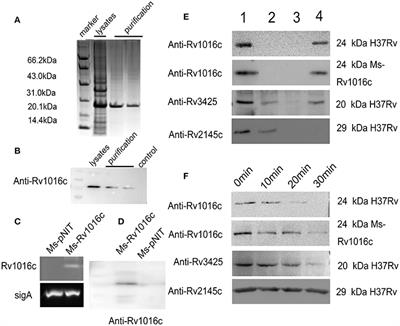 Recombinant Lipoprotein Rv1016c Derived from Mycobacterium tuberculosis Is a TLR-2 Ligand that Induces Macrophages Apoptosis and Inhibits MHC II Antigen Processing